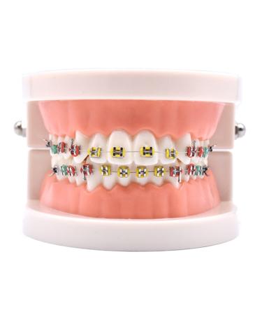 Angzhili 1 Piece Dental Demonstration Orthodontic Model with Metal Wires and Bracket (Metal bracket)