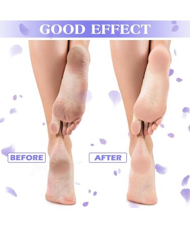 Tarpop 3 Pairs Aloe Socks Moisturizing Spa Socks for Dry Cracked Feet Infused Socks Gel Sleeping Fuzzy Socks Lotion Socks Gift for Christmas Women Men Softening Dry Feet(Purple and White) - Buy Online on GoSupps.com