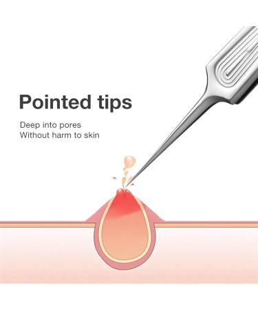 Acne Needle Ingrown Hair Tweezers Needle Nose Pointed Tips Eyebrows Tweezers for Splinters Blackhead Extractor (Color : Mr-2191S) - Buy Online on GoSupps.com