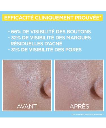 Garnier Pure Active BHA + Niacinamide Daily fluid with SPF 50+ against impurities light matte formula 40ml - Buy Online on GoSupps.com