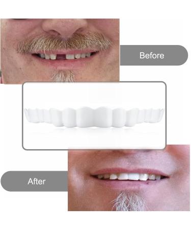 Flipped Warm Veneers - 2 Pairs of Cosmetic Fake Teeth for Instant Smile Transformation | Top & Bottom Immediate Dentures for Bad Teeth - Buy Online on GoSupps.com