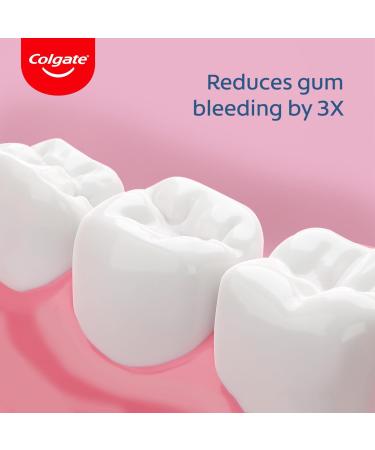 Colgate PerioGard Gum Expert Ultra Soft Toothbrush - Gentle Oral Care (1 pc) | International Shipping Available - Buy Online on GoSupps.com