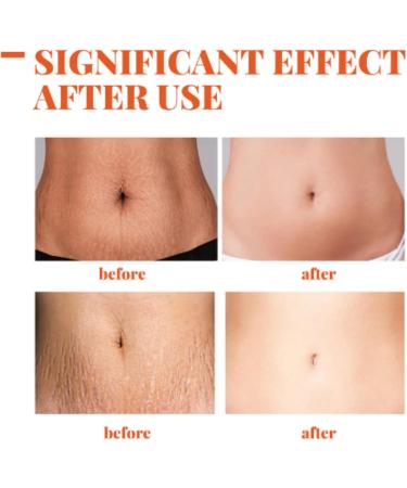 Optimal Oil Skin Regenerate Oil Body Oil Skin Care Collagen Boost Firming & Lifting Skincare Oil Stretch Marks Removal Stretch Mark Oil Improves the Appearance of Stretch Marks Oil for Scars 125ml - Buy Online on GoSupps.com