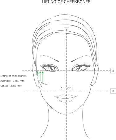 Fillerina Dermo Cosmetic Filler Treatment Grade 2 - Buy Online on GoSupps.com