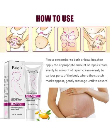 Stretch Marks & Scar Cream for Women | Body Repair Moisturizing Cream - 40g | Effective Post-Pregnancy Skin Care - Buy Online on GoSupps.com