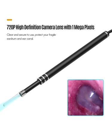 Namolit 720P Visual Ear Cleaner | Ear Wax Removal Endoscope Otoscope | 1MP | for Smartphone Tablet Computer | Cleaning Ear Mouth Nose Skin Pets Baby - Buy Online on GoSupps.com