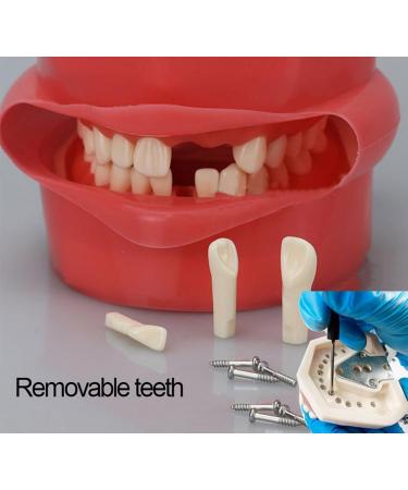 Dental Teaching Simulator with Removable Tooth Model and Rotatable Design Dental Phantom Head Model Dental Training Simulator Manikin for Teaching Practice Learning (Size : Clipped on The Table) - Buy Online on GoSupps.com