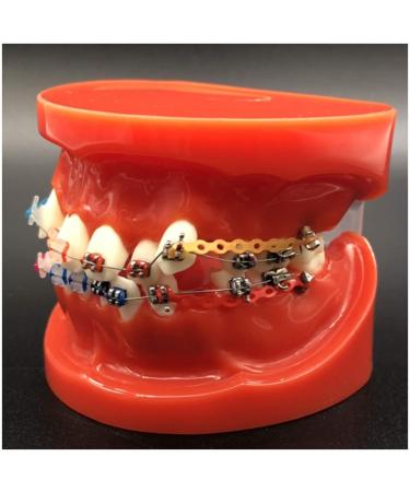 Dytah Toothpodont - Orthodontic Teeth Model with Mental Brackets & Ligature Ties | Red Study Tool for Teaching & Learning - Buy Online on GoSupps.com