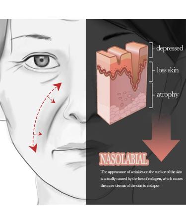 10 sheets of nasolabial fold plasters for women anti-wrinkle patches anti-wrinkle plasters for the face skin smoothing facial wrinkle pad facial wrinkle remover strips 160 pieces facial mask - Buy Online on GoSupps.com