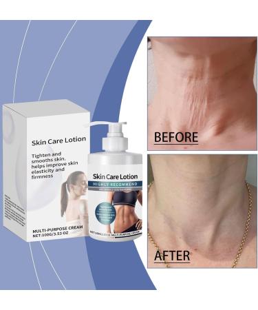 2 Pcs Skin Care Lotion Restore Skin Elasticity Coolord Luxelift Skin Firming Youth Butter Skin Tightening Cellulite Body Lotion Firming Cream for Loose Sagging Skin - Buy Online on GoSupps.com