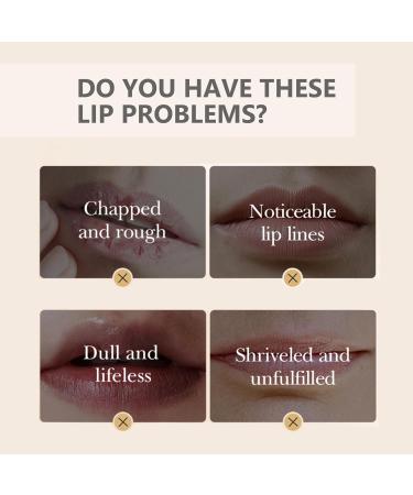 Virecose Lip Balm 8 Protective Lip Balm with Soft Finish 5 g - Buy Online on GoSupps.com