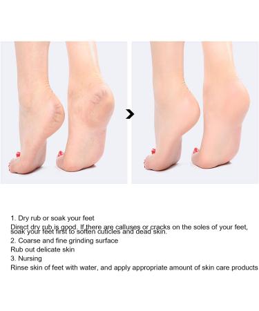 Portable Foot Callus Remover - Durable Pumice Stone for Men & Women | International Shipping Available - Buy Online on GoSupps.com