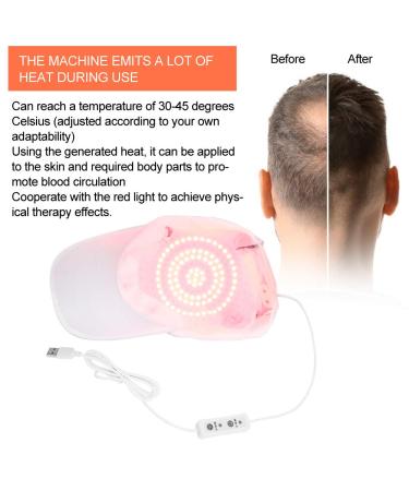 Revitalize Your Hair with Our Hair Growth Hat & Devices 94pcs Lamp Beads System for Fuller Hair - Buy Online on GoSupps.com