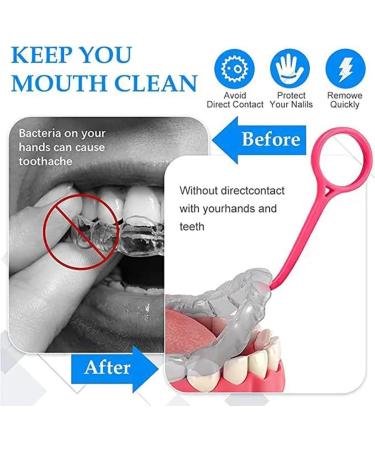12-Piece Tokaneit Aligner Distance Tools Set | Invisible Braces & Removal Tool for Perfect Smile - Buy Online on GoSupps.com