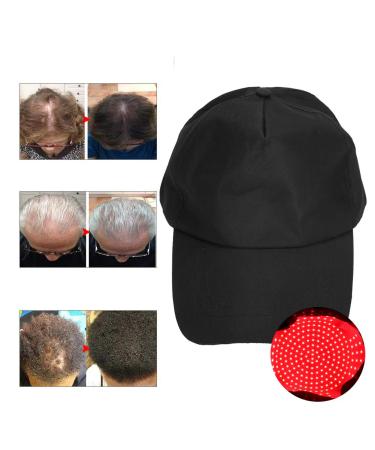 Hair Growth Helmet & Cap - USB Oil Control Treatment for Hair Loss | 256 Emission Therapy Hat - Buy Online on GoSupps.com