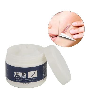 Scar Eraser Gel - Effective for Old & New Scars, Skin Repair & Removal Treatment - Buy Online on GoSupps.com