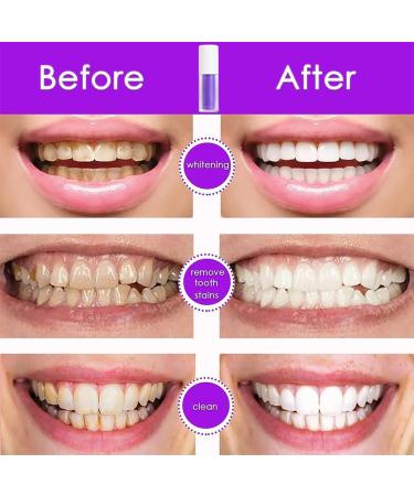 Whitening Toothpaste for Deep Stain Removal | Purple Tooth Whitening Formula for White Teeth - Buy Online on GoSupps.com