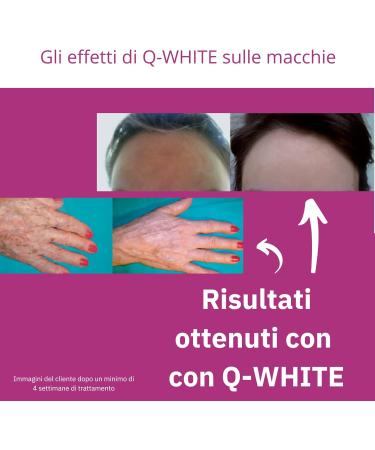 Q1 Q-White Brightening Treatment for Face and Body | Face and Brightening Cream for Removing Common Spots | Anti-Spot and Illuminating Face Serum 40 ml - Buy Online on GoSupps.com