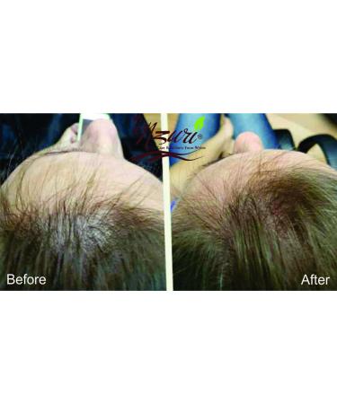 Nzuri Elixir Hair Skin and Nails Vitamins with Vitamin D | 32 oz for Women and Men - Buy Online on GoSupps.com