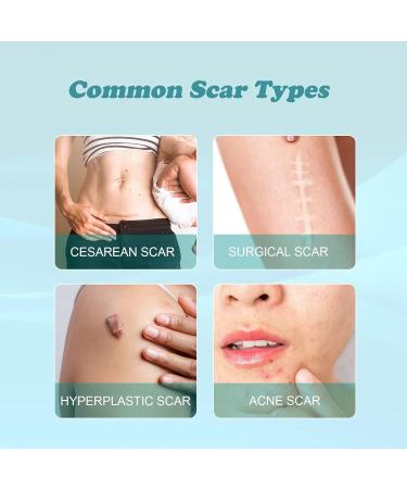 Scar Removal Spray- Advanced Formula for All Types of Scars - 2PCS - Buy Online on GoSupps.com