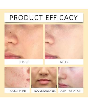 Moisturizing Toner - Deep Hydration Fast Absorbing Oil-Free Soothing Skin Care For Radiant Glowing Complexion(2PCS) - Buy Online on GoSupps.com