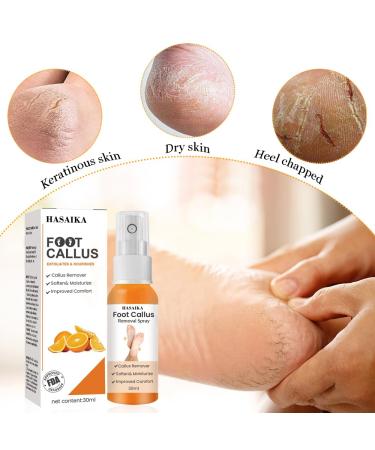 Foot Peeling Spray | Quick Callus Removal & Skin Care | Corneal Remover for Soft Feet - Buy Online on GoSupps.com