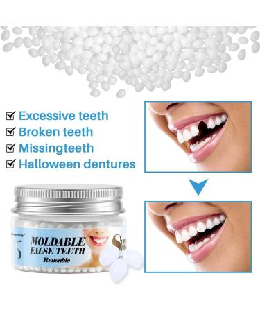 Fengyang Temporaire Des Dents Kit De R paration Dentaire Provisoire Fixation Temporaire pour Dentier Et Fausse Dent Naturelle A Poser - Buy Online on GoSupps.com