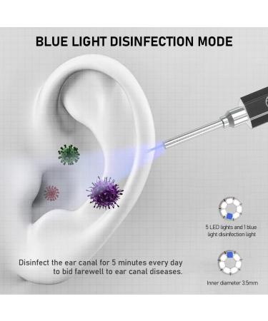 Buy OBEST Otoscope - 1080p Ear Camera with 5 LED & Germicidal Light | Compatible with Android iOS & iPad - Fast International Shipping - Buy Online on GoSupps.com