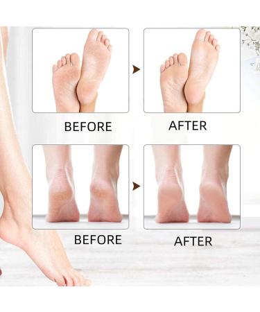 Electric Foot File Rechargeable Electric Feet Callus Remover Tool Foot File Hard Skin Remover Waterproof Feet Hard Skin with 2 Heads 2 Speeds for Home Spa Pedicure - Buy Online on GoSupps.com