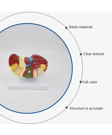 Liver Damage ical Model Liver Pathology Models Teaching Aids - 22.5 * 17 * 16CM - Buy Online on GoSupps.com