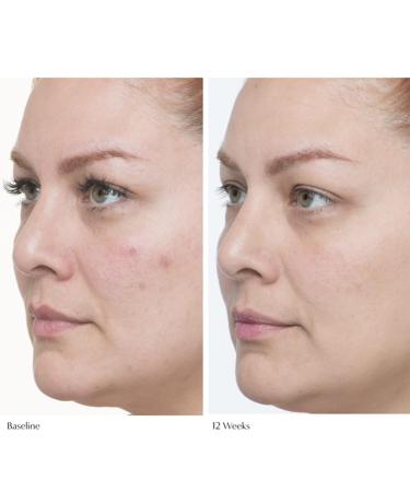 Le Prunier Plumscreen SPF 31 2oz - Broad Spectrum UVA/UVB/HEV protection PA - Buy Online on GoSupps.com