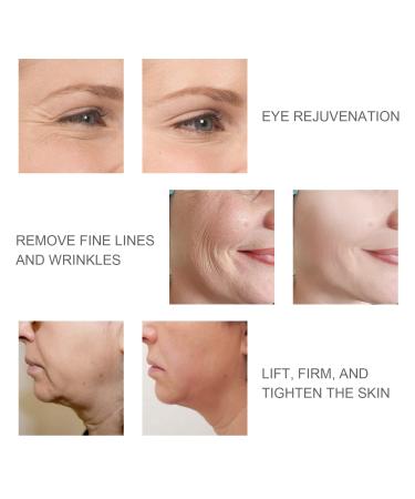 RF Radio Frequency Face Skin Tightening Machine - Facial Device for Lifting, Firming, and Wrinkle Reduction - Beauty Tool for Eyes, Neck - Black - Buy Online on GoSupps.com