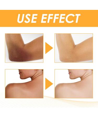 Boxiatil Click to see full view Turmeric Oil - Intense Whitening Oil with Turmeric Serum for Luminous Skin Essential for Skin Care To Lighten Dark Skin - Buy Online on GoSupps.com