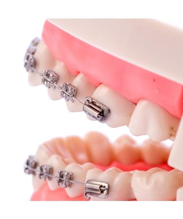 Buy Dental Orthodontic Standard Teeth Model with Metal Brackets & Wires - International Shipping Available - Buy Online on GoSupps.com