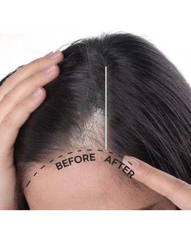 Scalp Intensive Shampoo - Peptide Anti-Hair Loss Shampoo for Men & Women | Korean Hair Regrowth & Thickening with Biotin & Panthenol (13.52 fl oz - Buy Online on GoSupps.com