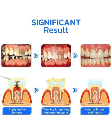 Buy Furzero Propolis Oral Instant Treatment Spray - 10ml | Teeth Whitening & Total Care Mouthwash | Fresh Breath Solution - Buy Online on GoSupps.com