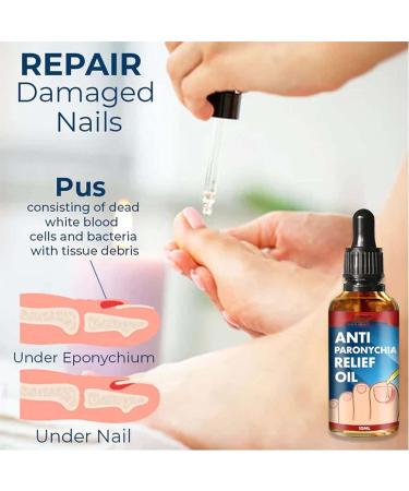2PCS German Toenailplus Anti Paronychia Relief Oil - Nail Repair for Damaged Thick Nails - Buy Online on GoSupps.com