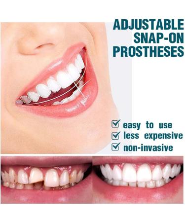 Eliav 2 Couples False Teeth Veneers - White Dentures for Top & Lower Jaw | Temporary Cosmetic Tooth Covers - Buy Online on GoSupps.com