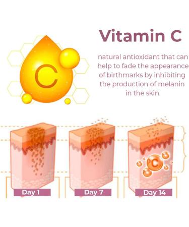 DUBUSH GFOUK German Birthmark Removal Oil Vitamin C Serum Collagen Dark Spot Repair Cream Hyperpigmentation Repair - Buy Online on GoSupps.com