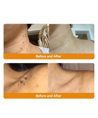 Bee Venom Skin Treatment Cream Fast-Acting & Gentle Care for All Skin Types (30ml) | Advanced Skin Therapy - Buy Online on GoSupps.com