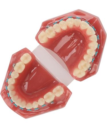 Typodont Orthodontic Tooth Model (28 Teeth) - Realistic Crowded Teeth & Malocclusion Representation for Dental Education & Practice - Buy Online on GoSupps.com
