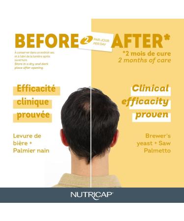 NUTRISANTE Nutricap for Men Hair Growth Advanced Formula - Hair Vitality and Strength for Men - Natural Walnut Oil Whey Saw Palmetto Horsetail extract Biotin - 120 capsules - 2 Months Treatment - Buy Online on GoSupps.com