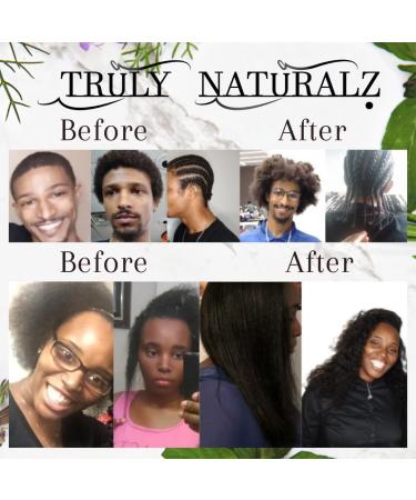 Natural Rapid Growth Grease | Balding Balm for Fast Hair Growth | Reduce Hair Loss & Dandruff - Buy Online on GoSupps.com