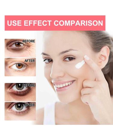 Turmeric Vitamin C Eye Stick - Brightening Eye Cream for Dark Circles & Swelling (2PCs) - Best Dark Spot Remover & Eye Balm - Buy Online on GoSupps.com