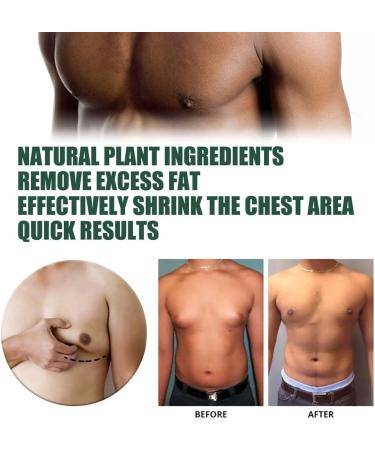 Chestdefy Gynecomastia Reduction Massage Oil & Tightening Cream - Breast Reduction for Men (2PCs) | Effective Solution for Gynecomastia - Buy Online on GoSupps.com