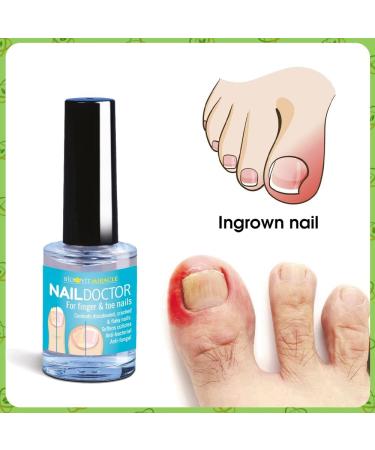 VYTALIVING BioClear Nail Doctor - Ingrown Toenail Treatment - Fungal Nail Treatment for Toenail Aids in Toe Nail Care | 15 ml - Buy Online on GoSupps.com