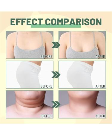 Beauty Lady Collagen Lifting Body Oil Firming and Lifting Skin Care Oil for Neck D collet Upper Arms and Thighs Reduces Fine Lines - Buy Online on GoSupps.com