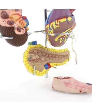 Uigjiog Human Diabetes & Cardiac Model - Coronary Thrombosis & Arterial Education Tool for Blood Vessels Brain Heart Pancreas and Foot Surgery - Buy Online on GoSupps.com
