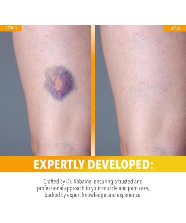Dr. Robaina Arnica Bruise Relief Salve - Fast Natural Healing for Arms Legs & Hands | 6 oz - Buy Online on GoSupps.com