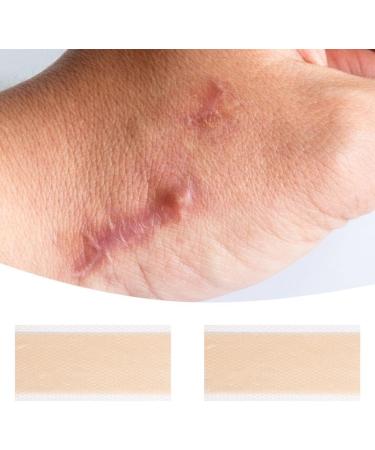 4Pcs Silicone Scar Repair Patch - Lighten Pigmentation, Odorless, Effective Skin Repair - Color S - Buy Online on GoSupps.com